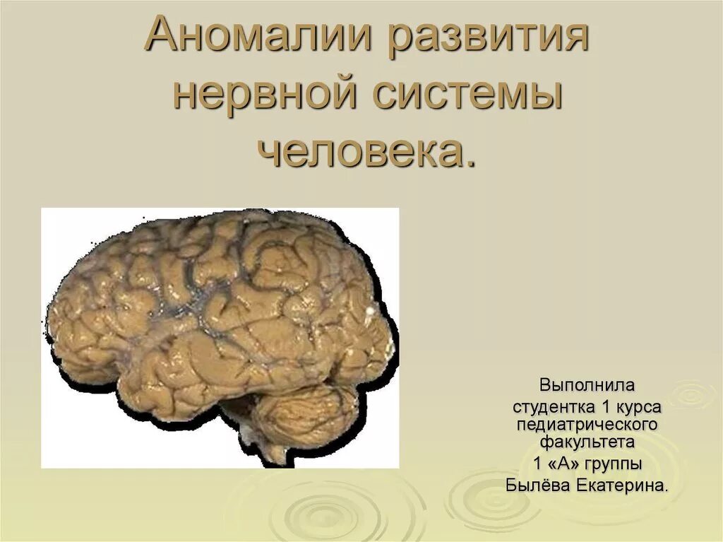 Аномалии и пороки развития нервной системы. Аномалии развития нервной системы человека.. Патологии в развитии нервной системы. Аномалии центральной нервной системы.