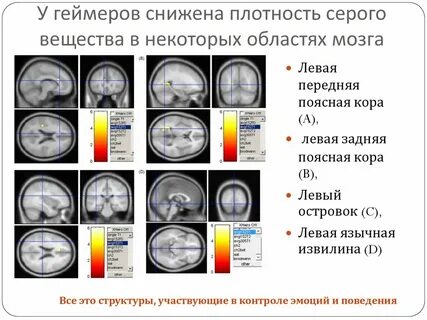 Плотность серого вещества
