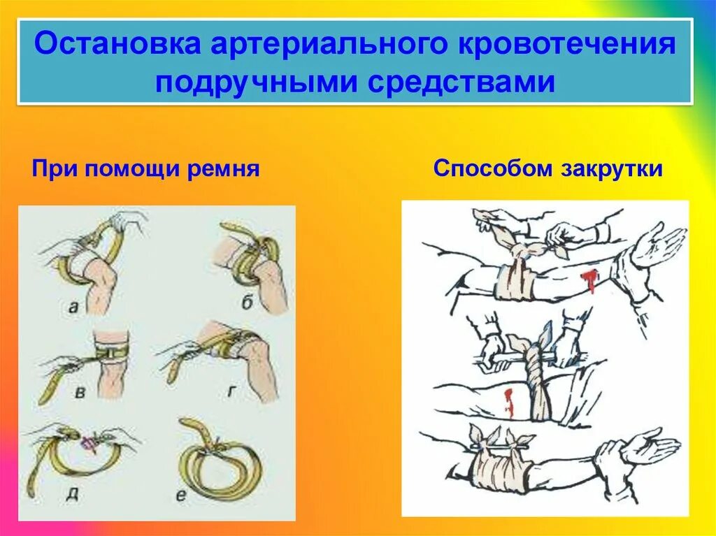 Подручные средства для остановки артериального кровотечения. Остановка артериального кровотечения. Остановка артериального кровотечени. Способы остановки артериального кровотечения.