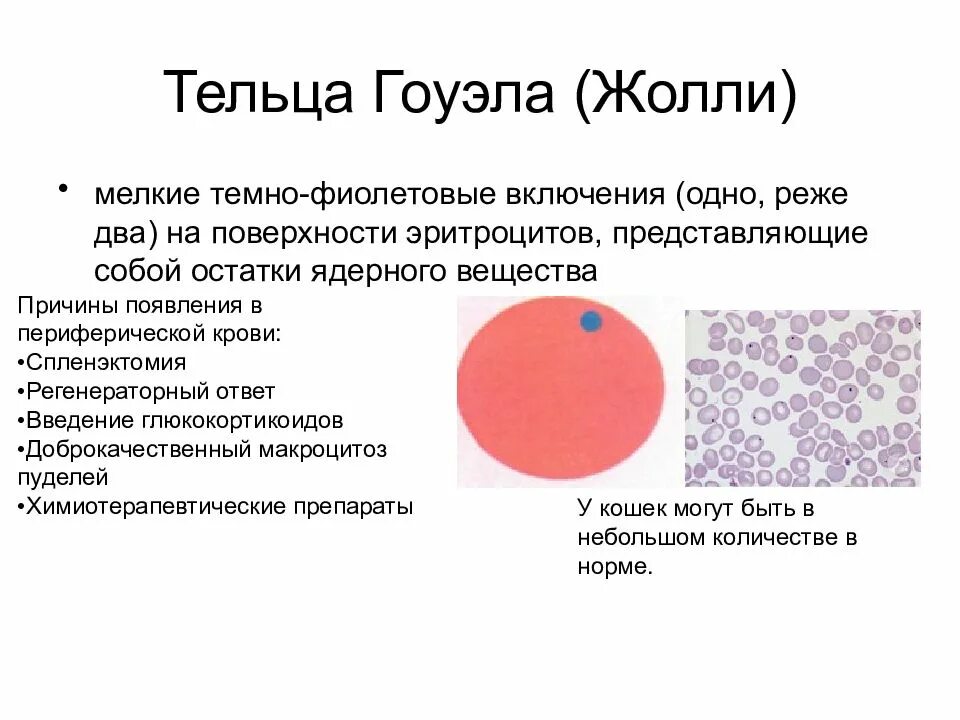 Цитоплазма эритроцитов человека. Тельца Жолли и кольца Кебота. Кольца Кебота в эритроцитах. Тельца Жолли кольца Кебота анемия в12. Включения в эритроцитах тельца Жолли.