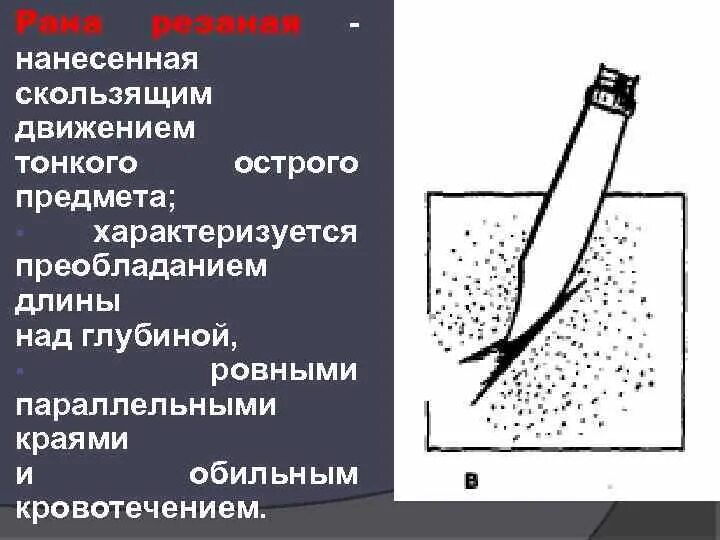 Какие раны характеризуются. Рана нанесенная острым тонким предметом. Резаные раны характеризуются. Резаная рана наносится. Резаная рана нанесённая острым предметом.