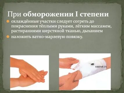 Можно ли растирать обмороженные
