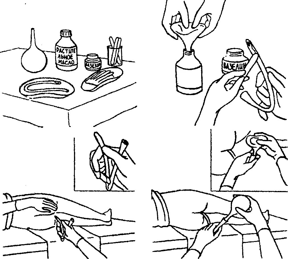 После масляной клизмы опорожнение наступает. Постановка лекарственной клизмы алгоритм. Масляная послабляющая клизма оснащение. Постановка лекарственной микроклизмы алгоритм. Постановка масляной клизмы алгоритм.
