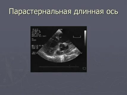Длинная ось