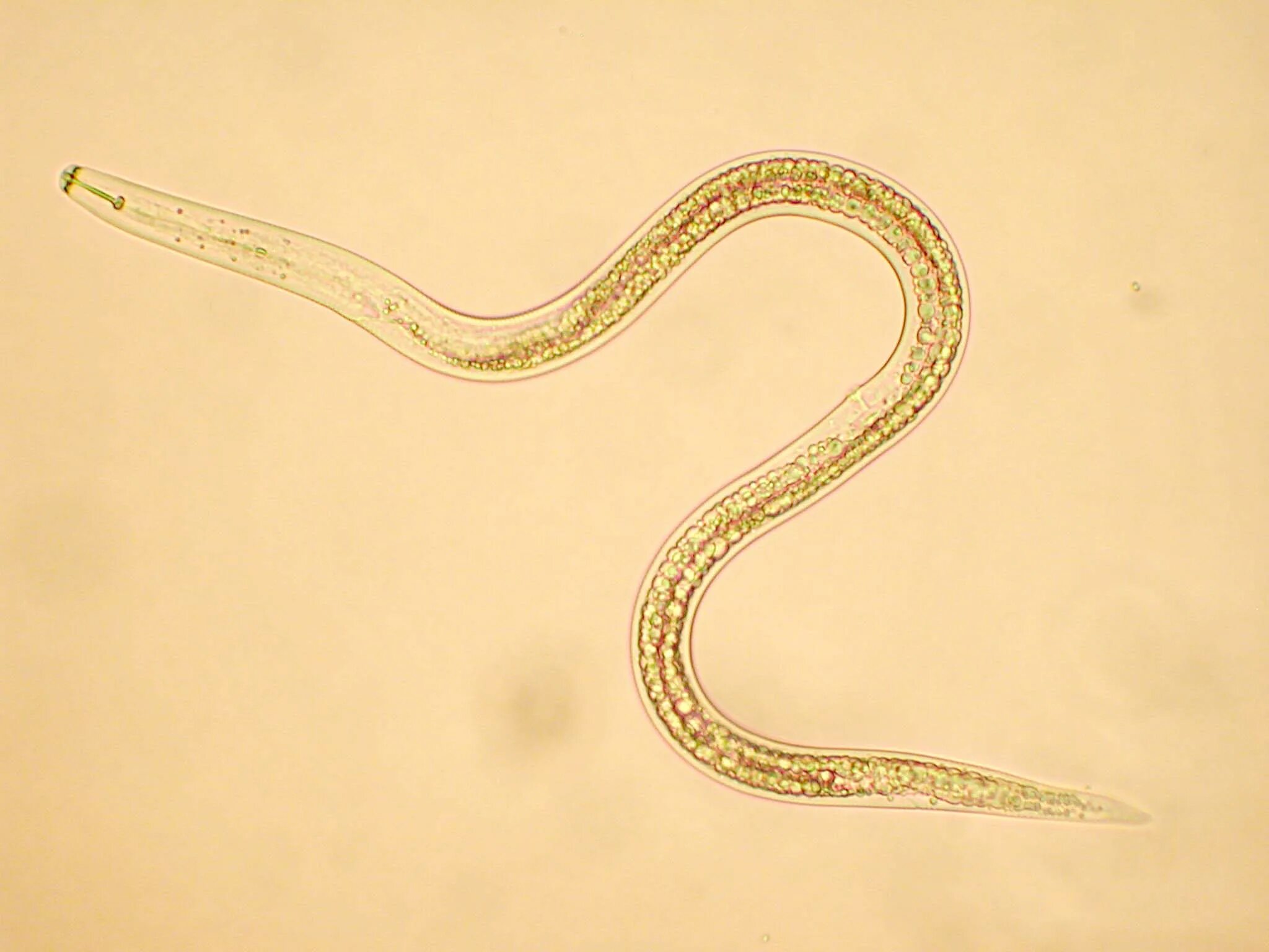 Лестничные черви. Нематода Мононх. Почвенная нематода Тип червей.