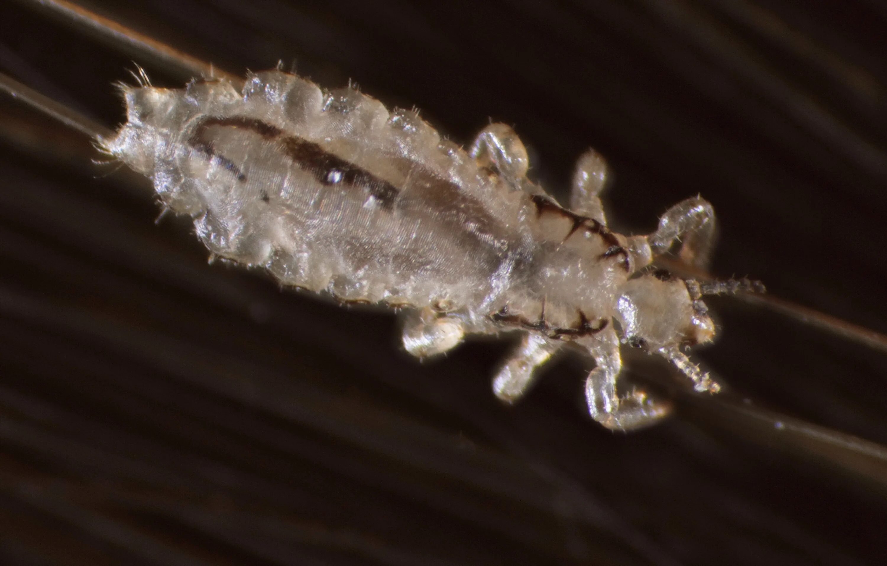 Головная вошь (pediculus humanus capitis). Lice. Lice. Головная вошь (pediculus humanus capitis). Вши паразитические насекомые.