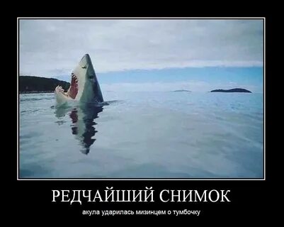 Ударился мизинцем об тумбочку