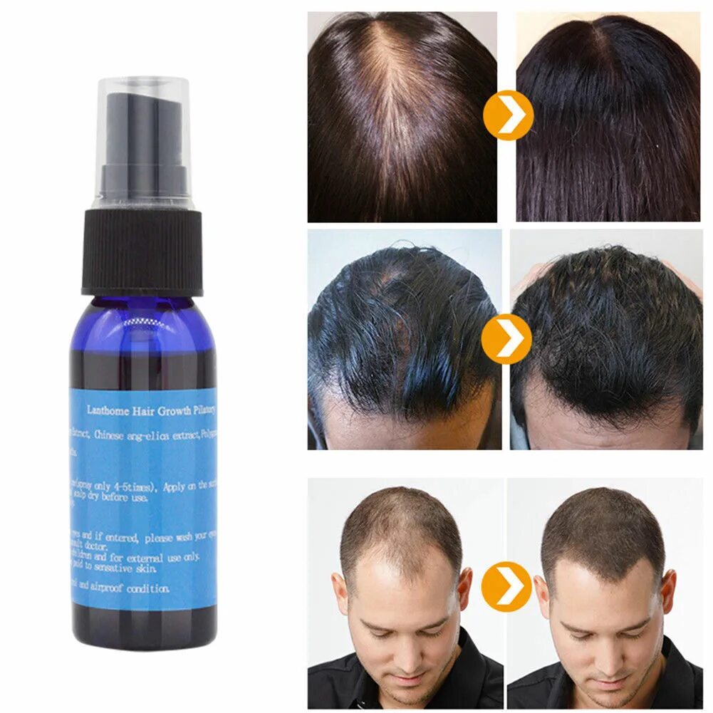 Восстанавливающие средства для волос. Hair growth , Хаир спрей. Hair growth Serum спрей. Minoxidil Spray for hair. Спрей для роста волос миноксидил.