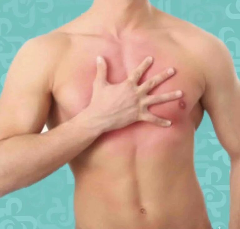 При вдохе болит левая сторона. Невралгия грудной клетки симптомы. Межреберная невралгия грудной клетки. Покраснела область груди. Покраснение на груди у мужчин.