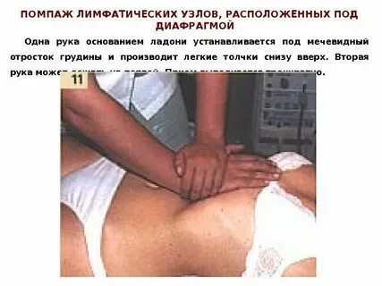 Массаж мечевидного отростка грудины