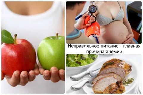 Анемия во время родов