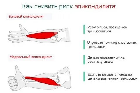 Лечение локтевого
