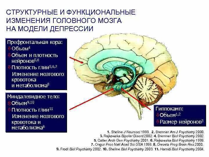 Структурные изменения в мозге. Структурные изменения в мозге