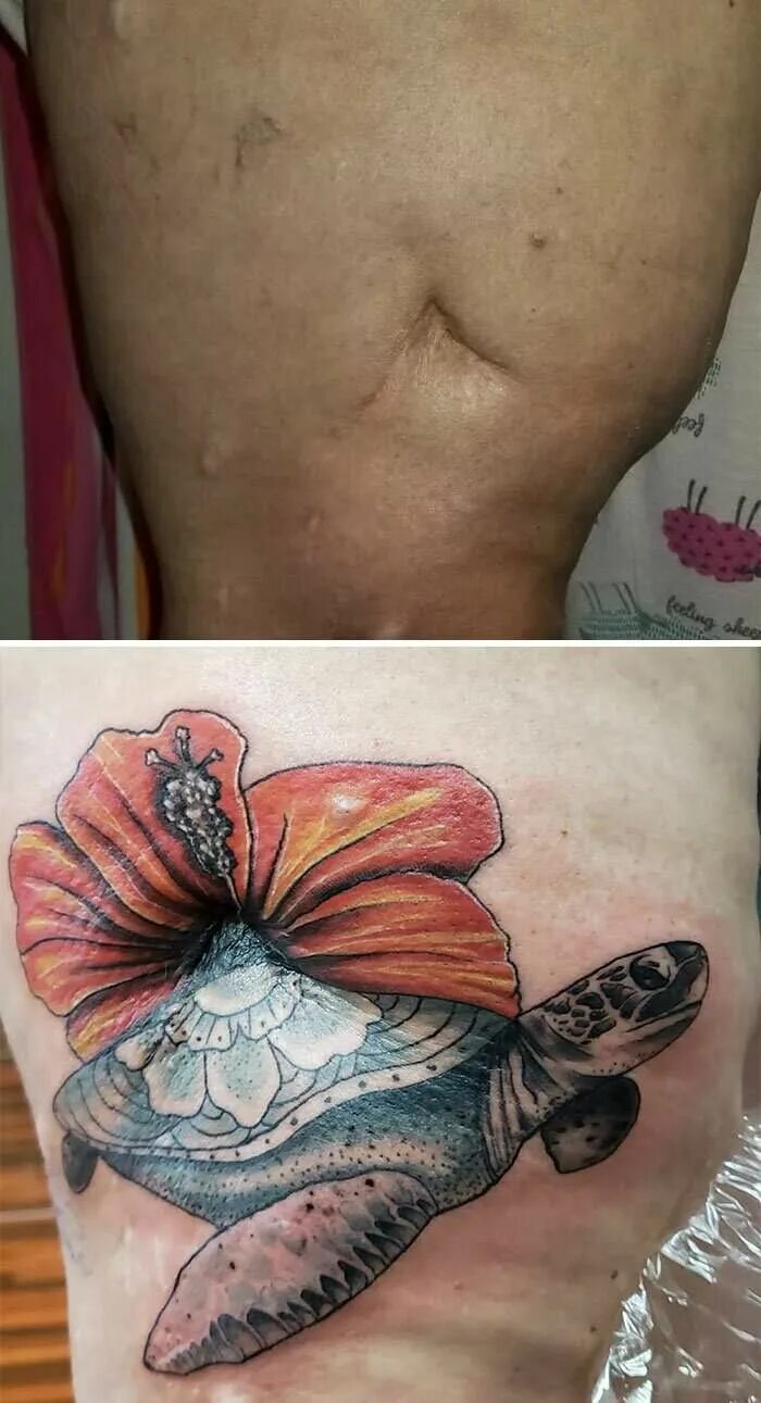 Тату звездочка на лице. Тату на прыщах можно ли. Тату на прыщах можно ли. Тату на прыщах можно ли. Небольшие прыщики на татуировке.