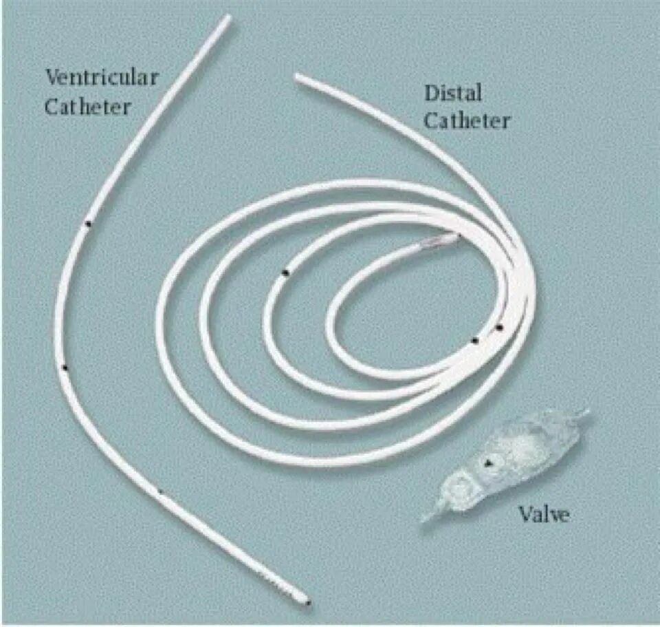 Клапан катетер. Медтроник катетер катетер для помпы. Шунт Medtronic среднего давления. Вентрикулоперитонеальный шунт Медтроник. Перитонеальный катетер улитка.