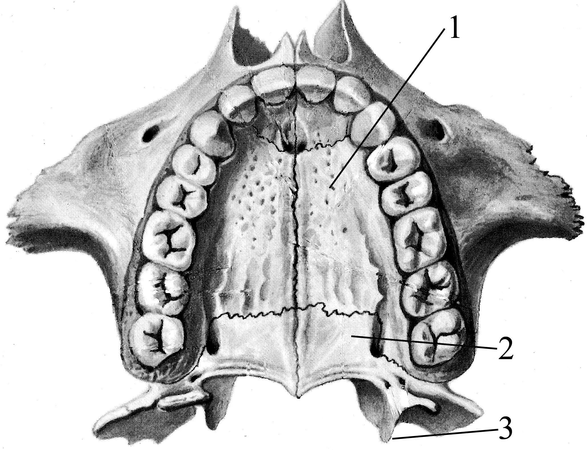 Костная основа полости рта. Анатомия твердого неба верхней челюсти. Небный отросток анатомия. Небный шов верхней челюсти.