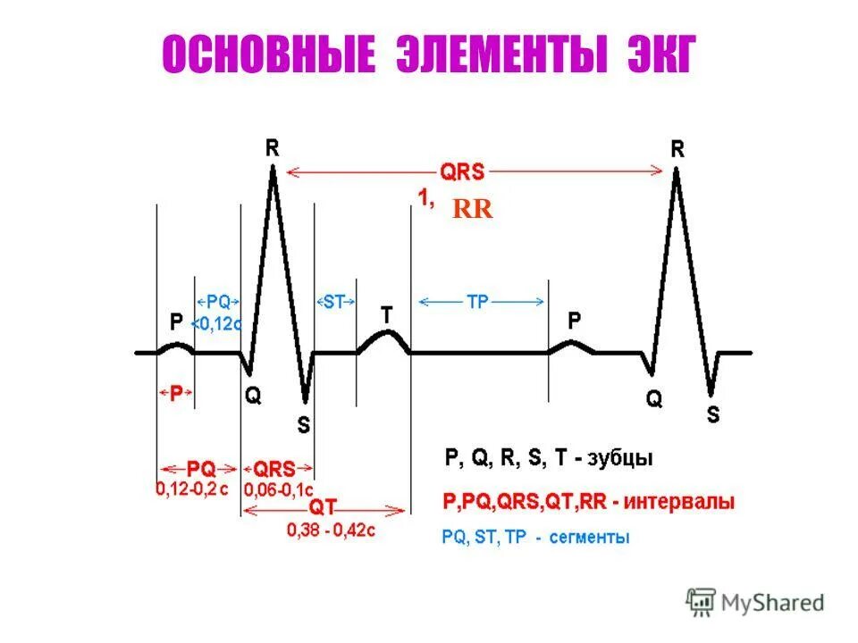 Экг 22. Отрицательный зубец р после QRS комплекса. Зубец р на ЭКГ норма. Нормы зубцов ЭКГ. Интервалы и сегменты ЭКГ В норме.