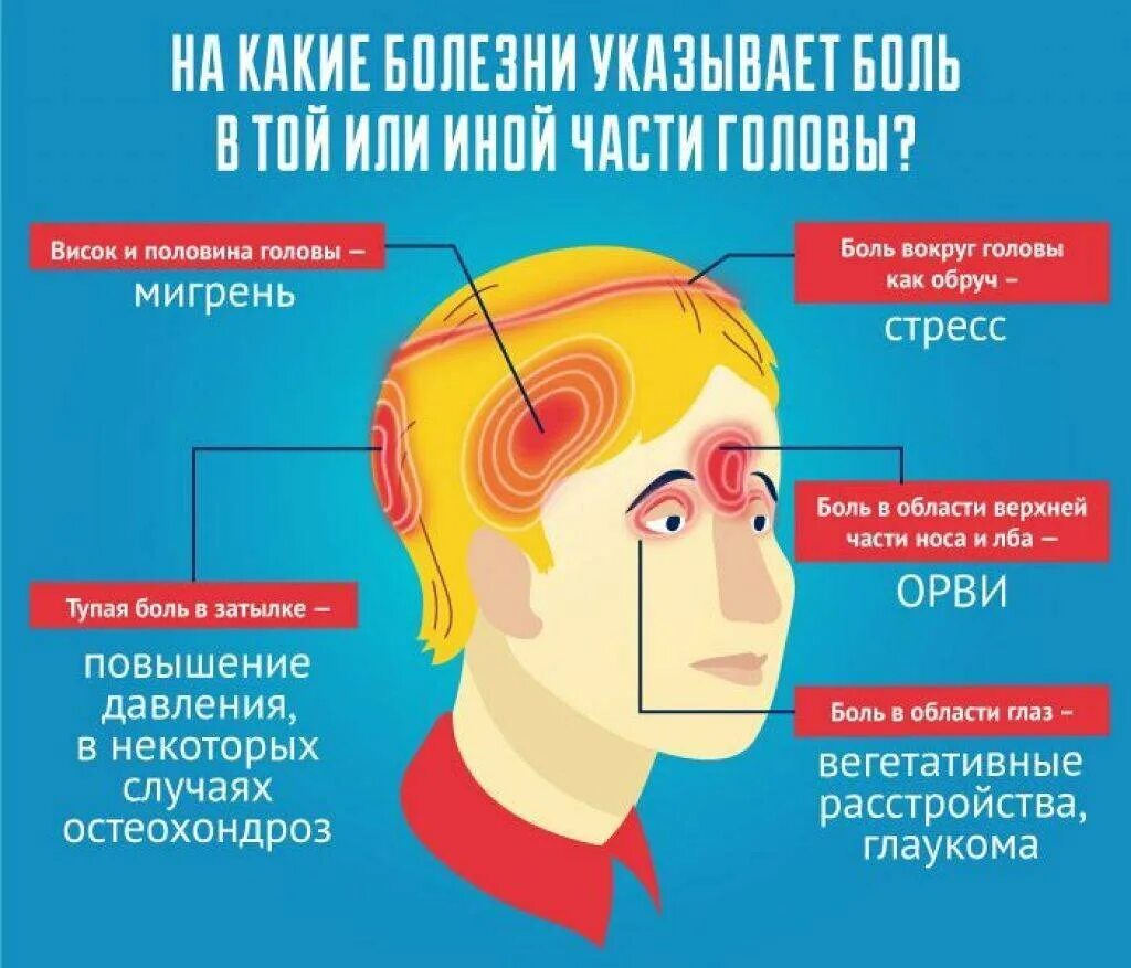 Каждый день болит голова что делать. Болит голова. Причины головной боли. Головная боль локализация.