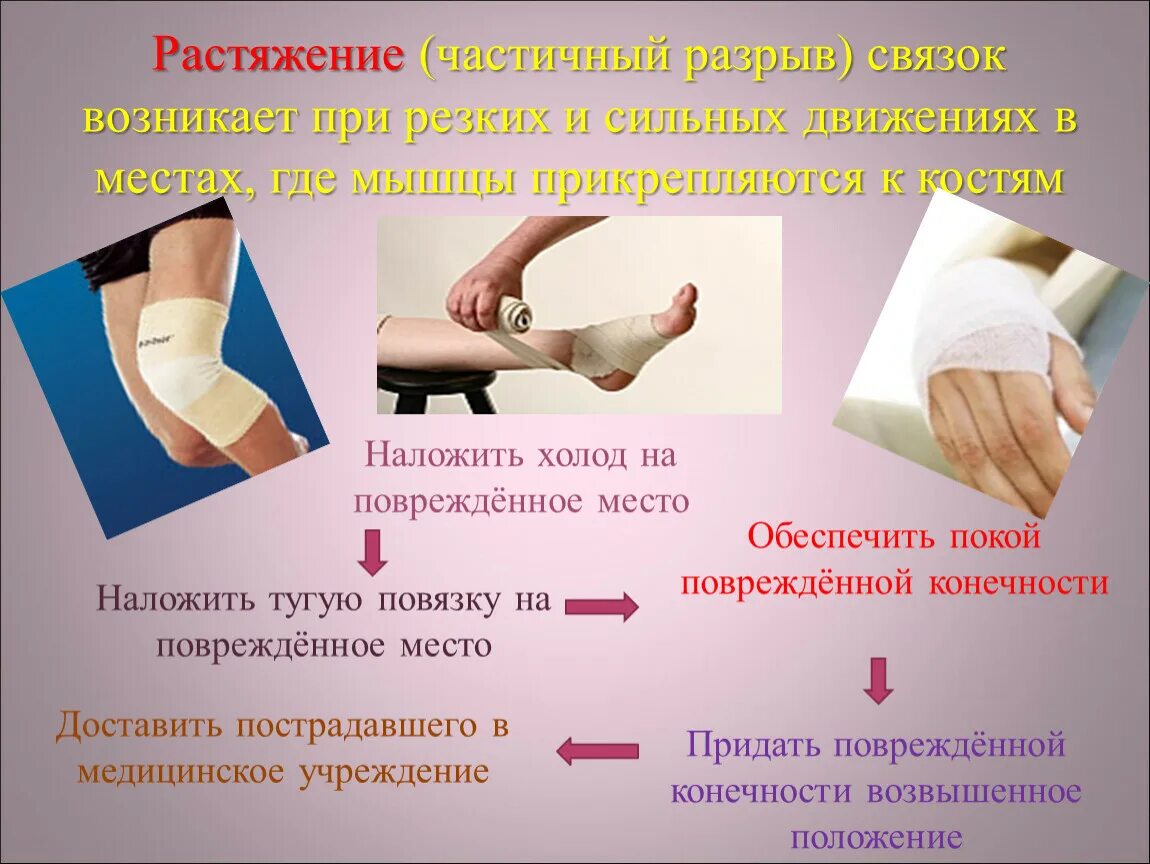 ПМП при растяжении и разрыве связок. Первая доврачебная помощь при растяжении связок. Первая медицинская помощь при разрывах связок и мышц — это:. При растяжении связок для оказания первой помощи рекомендуется.