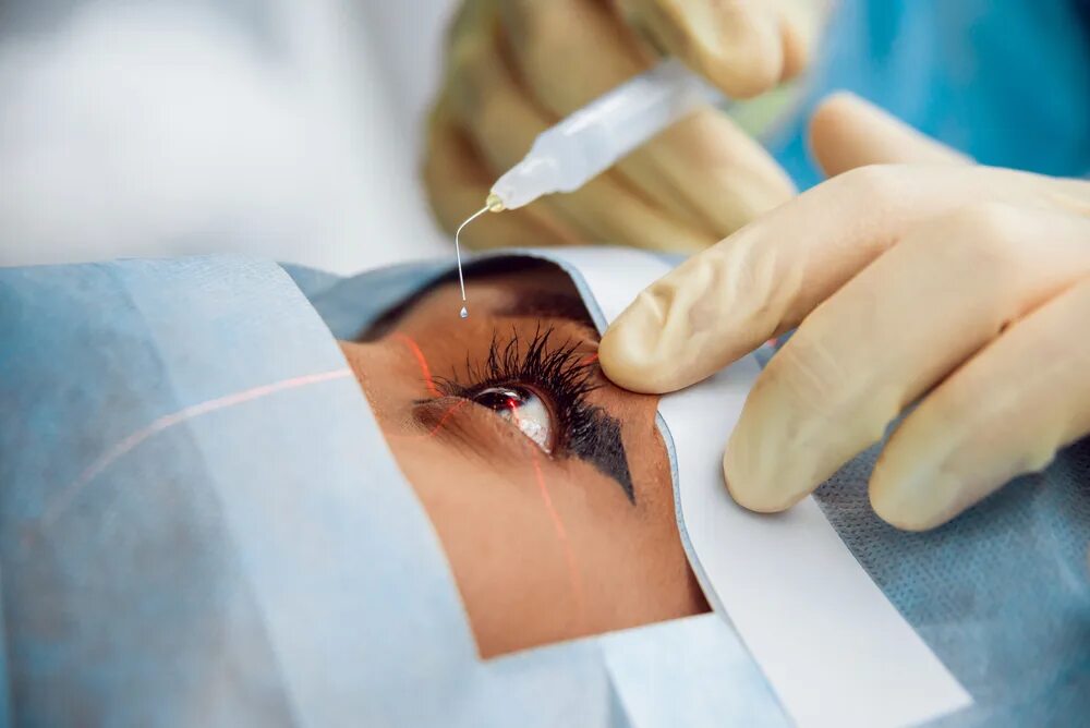 Анестезия в офтальмологии. Хирургическая операция на глаза. Лазеры в офтальмологии хирургии. Лазерная операция восстановление