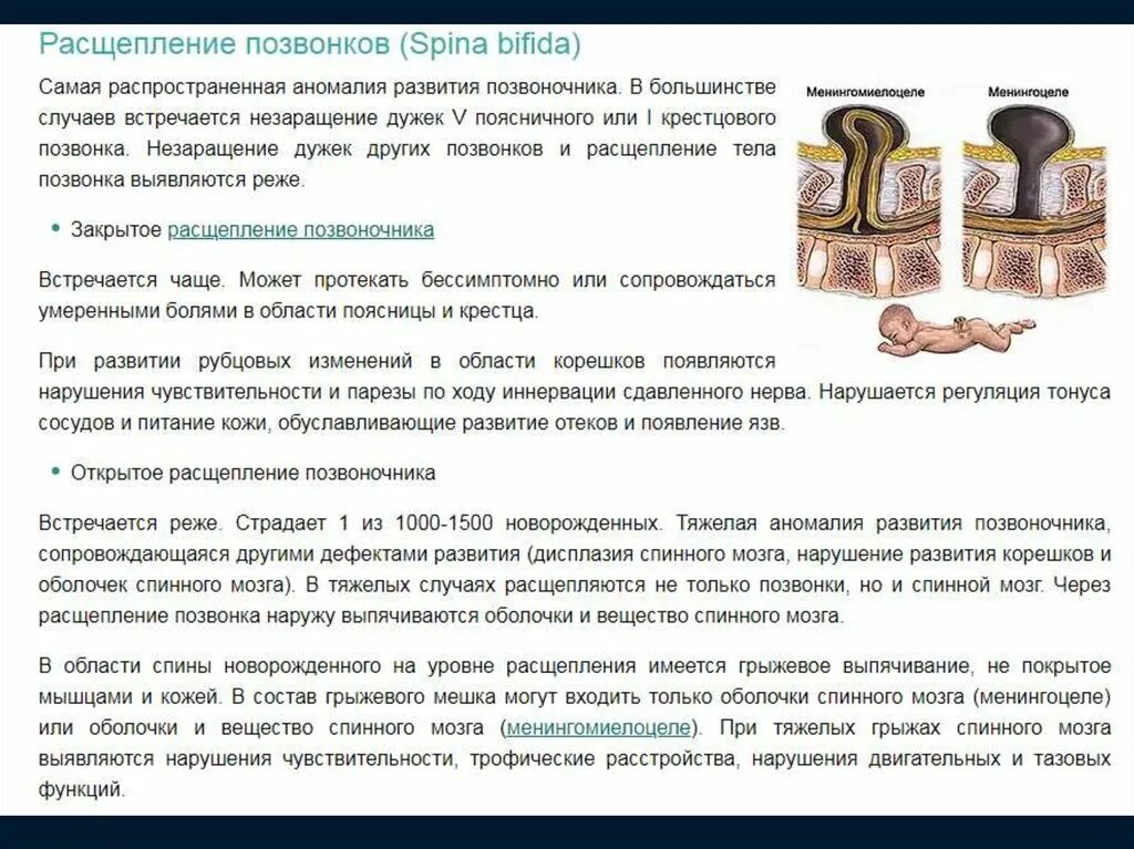 Аномалии развития позвоночника. Расщепление позвоночника. Открытое расщепление позвоночника.