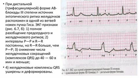 Блокада инструкция