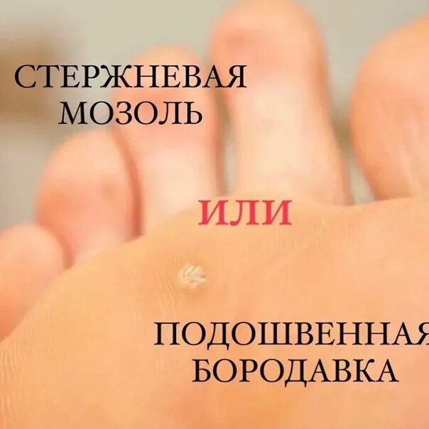 Вебинары по педикюру от компании Пластэк - Москва