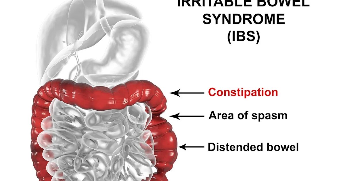 Ibs life