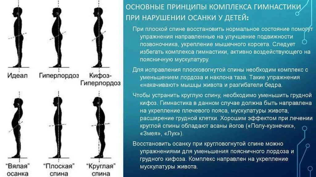 Плоская спина это нарушение осанки. Упражнения для плоской осанки. Упражнения для осанки при кифозе. Физкультура при нарушении осанки.