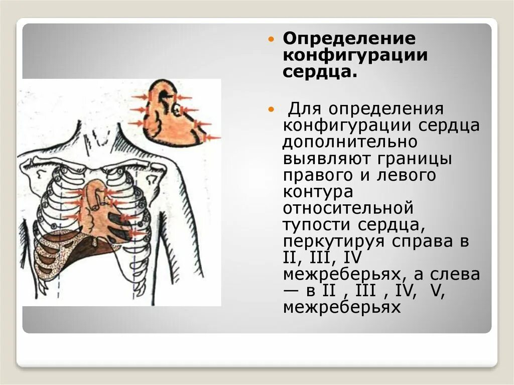 Конфигурации сердца. Нормальная конфигурация сердца. нормальная конфигурация сердца схема. определение конфигурации сердца. конфигурация сердца в норме.