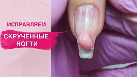 Почему скручиваются пальцы