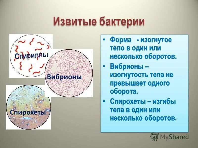 Микроорганизм имеющий форму запятой кроссворд. Извитые бактерии. извитые формы микроорганизмов. извитые бактерии микробиология. извитые бактерии классификация.