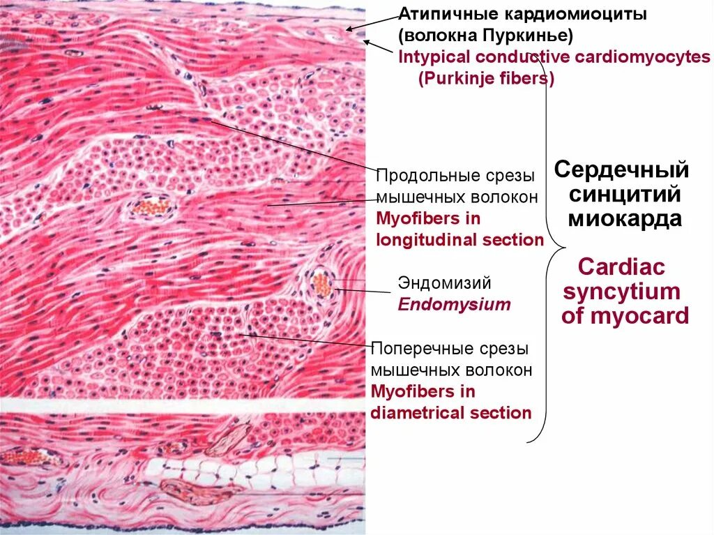 Волокна сердечных мышц. Миокард волокна пуркинье гистология. гистология кардиомиоцитов. атипичные кардиомиоциты волокна пуркинье. волокна пуркинье препарат гистология.