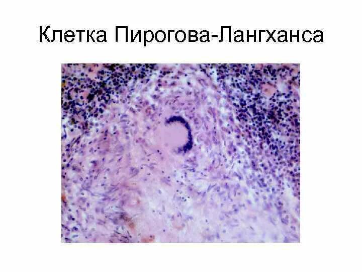 Клетка типа инородных тел. Клетка типа инородных тел