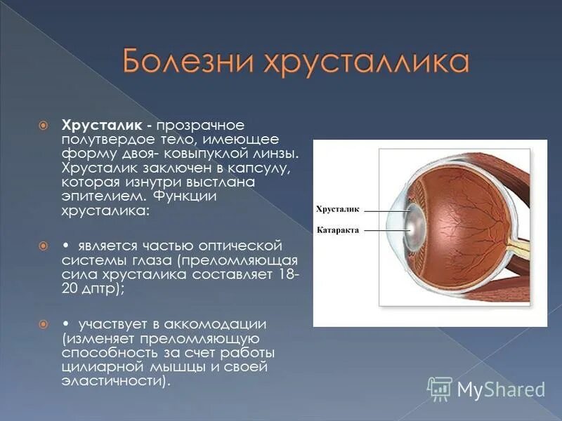 капсула хрусталика глаза. строение хрусталика глаза. хрусталик строение анатомия. помутнение задней капсулы хрусталика. мрт орбит изменения хрусталика.