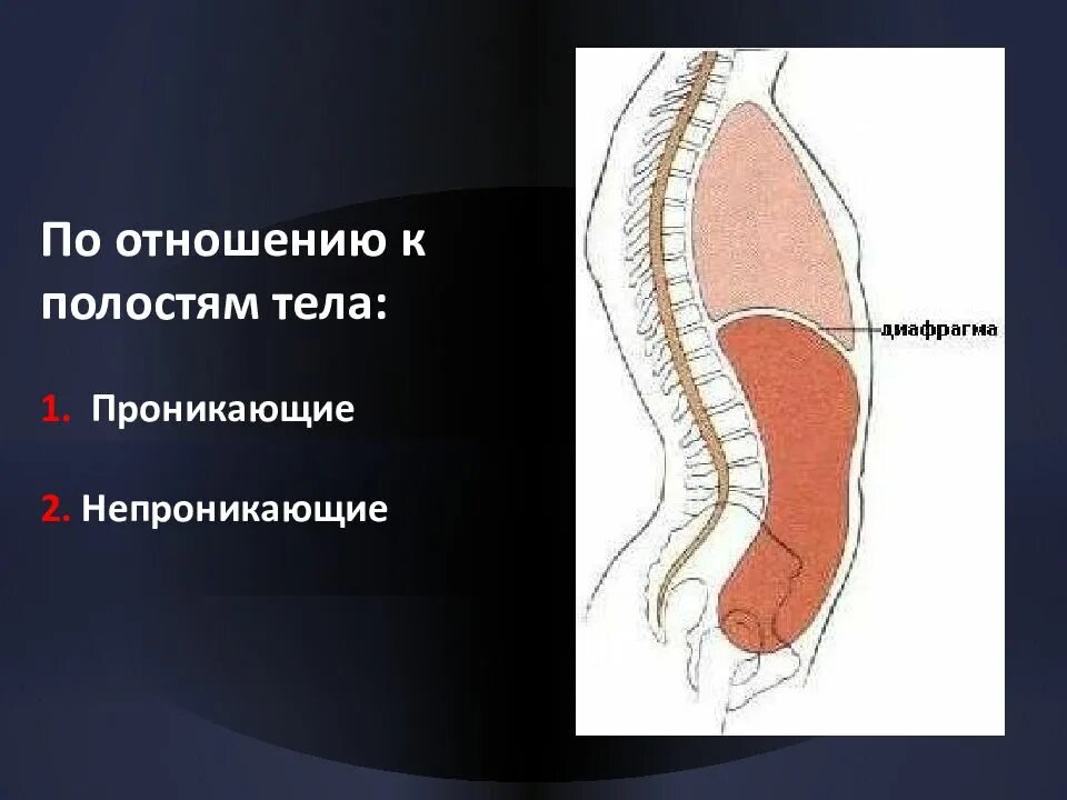 Проникающее и непроникающее ранение. Проникающие и непроникающие ранения. проникающие и непроникающие раны брюшной полости. непроникающее огнестрельное ранение. проникающие и непроникающие травмы живота.