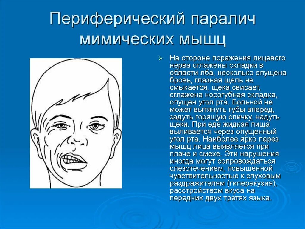 Лицевой информация
