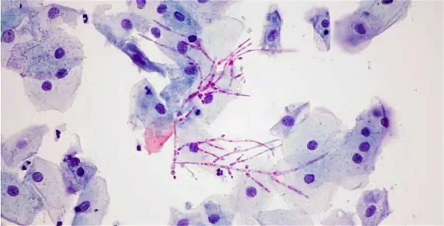 Антитела к candida albicans