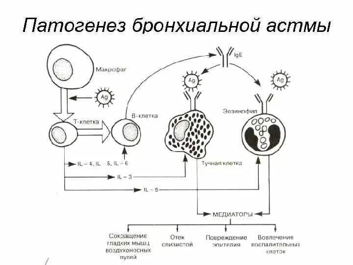 Схема ба. Патогенез аллергической бронхиальной астмы. Механизм развития бронхиальной астмы схема. Патогенез бр астмы. Патогенез бронхиальной астмы схема.