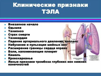 Признаки легочной артерии