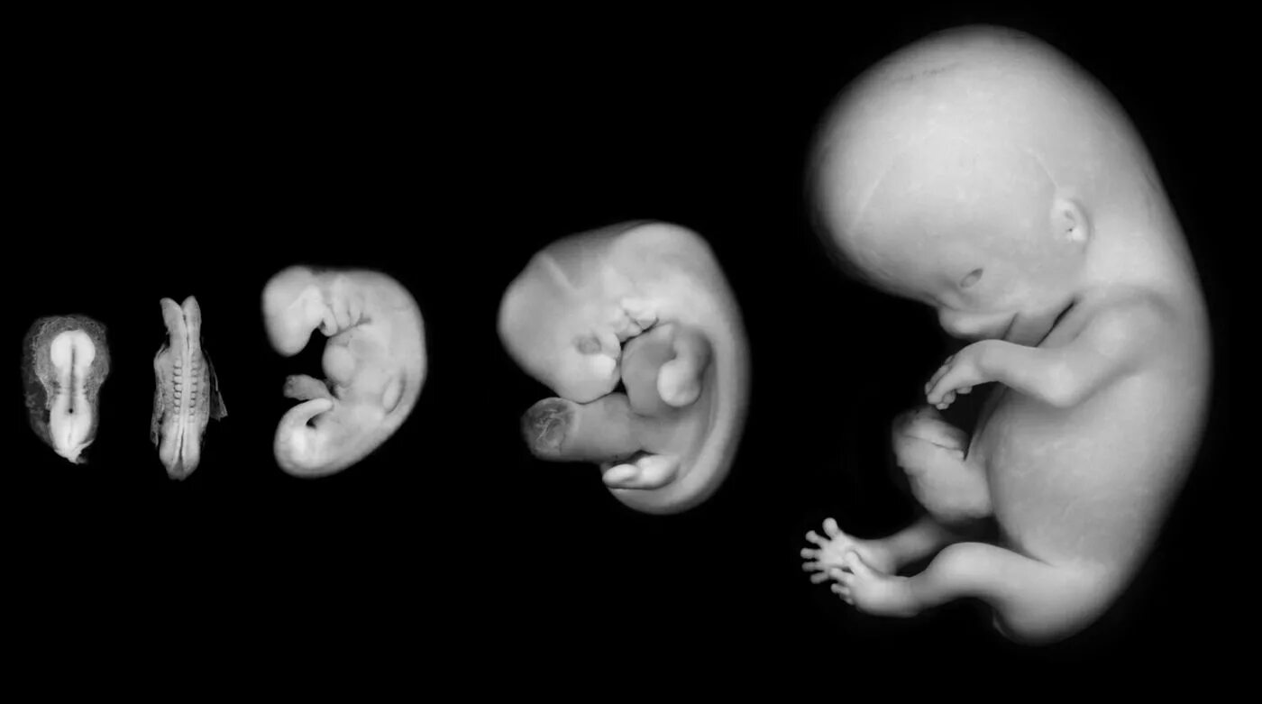 Наличие хвоста у зародыша человека на ранней. Человеческий эмбрион с хвостом. Хвост у зародыша человека.