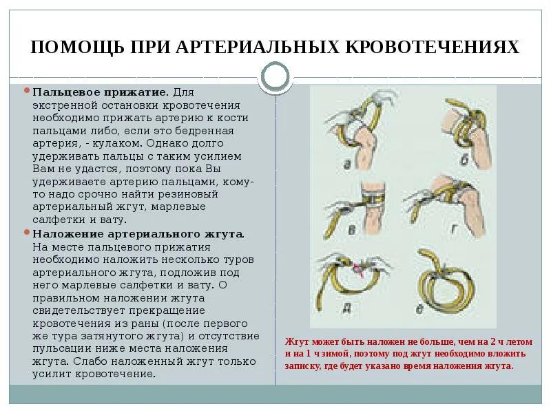 Принципы наложения жгута. Наложение жгута при кровотечениях. Наложение жгута при артериальном кровотечении. Схема наложение жгута при кровотечении. Как правильно наложить артериальный жгут