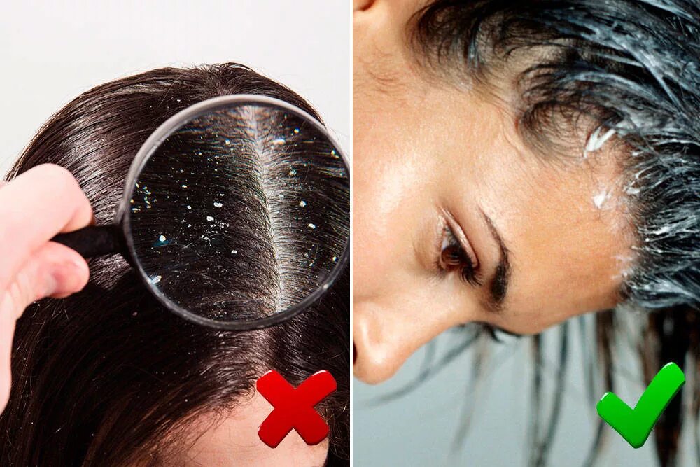 Лучшие пилинги и скрабы для кожи головы. Пилинг для кожи головы. Пилинг для кожи головы. Пилинг для кожи головы. Пилинг для волос и кожи головы в домашних.