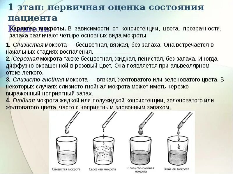 Кашель с неприятным запахом. Причины образования мокроты. Каизбавится.,от.мокроты.. Как избавиться оттмакроты. Как избавиться ТТ макроты.