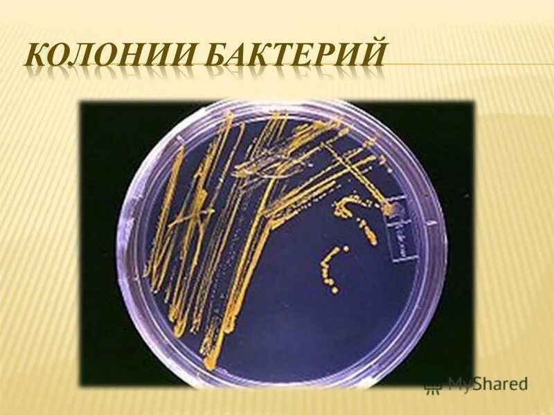 Бактерии округлой формы. Колониальные бактерии. Колонии микроорганизмов. M колонии бактерий. Колония микробов это.