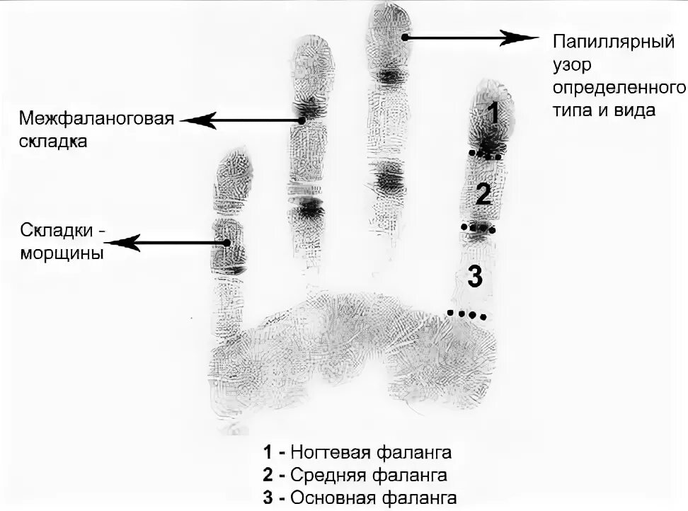 Ногтевая фаланга на руке