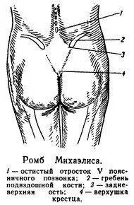 Ромб михаэлиса размеры