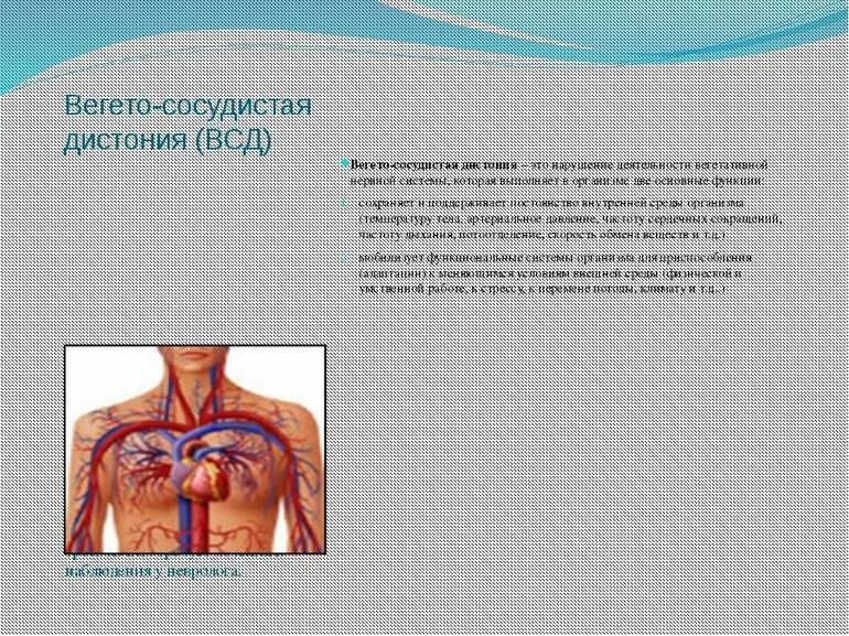 Всд 1. Сосудистая дистония. Вегето-сосудистая дистония что это. Легочно сосудистая дистония. Вегето-сосудистая дистония картинки.