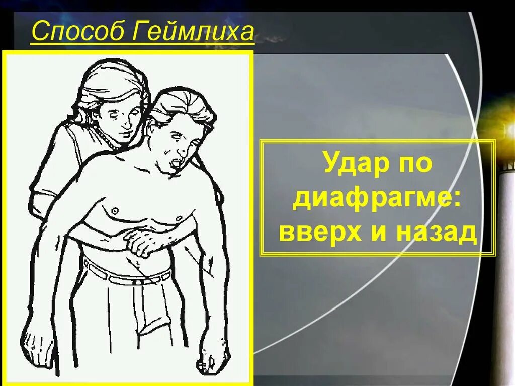 Прием геймлиха у беременных. Способ геймлиха. метод геймлиха. удар геймлиха. прием геймлиха.