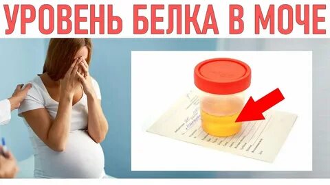 Плохая моча во время беременности